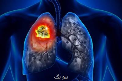ارتباط آلودگی هوا با افزایش مبتلا شدن به سرطان ریه