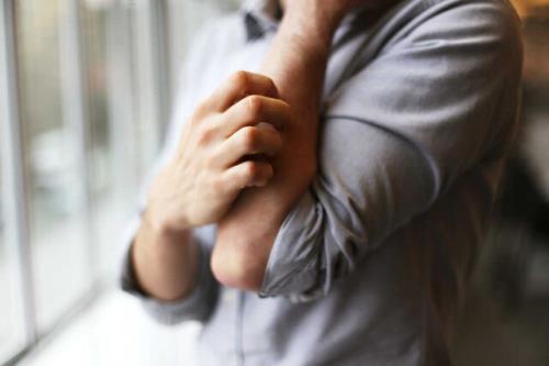 چرا خاراندن، خارش مزمن را بدتر می کند؟