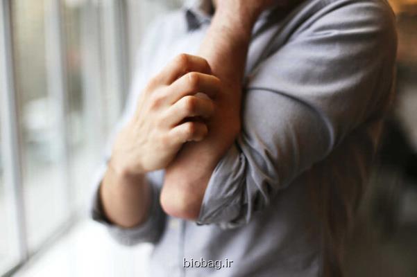 چرا خاراندن، خارش مزمن را بدتر می کند؟