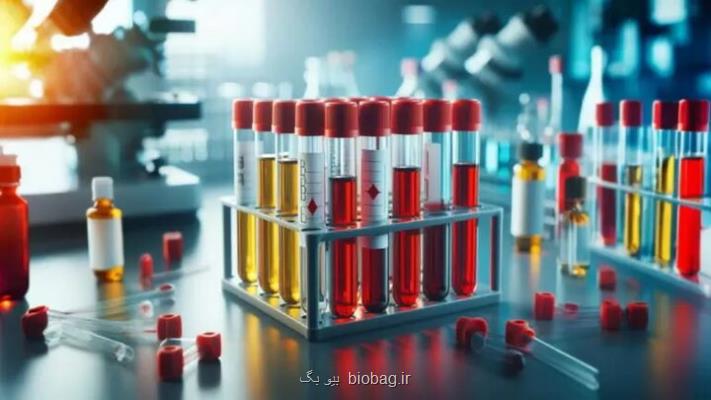 ایران به دانش فنی تولید داروهای مشتق از پلاسما رسید