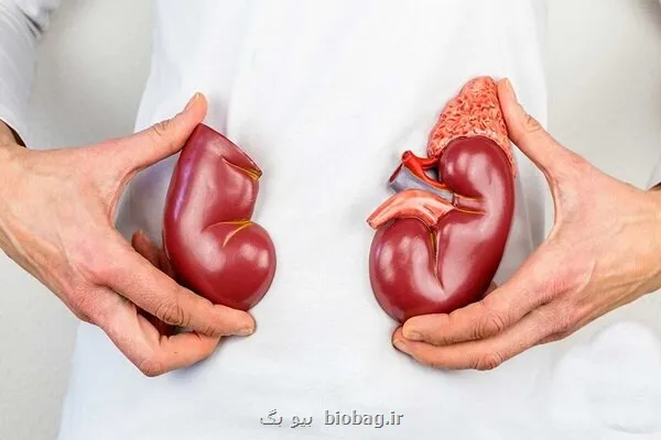 پیش گیری از بیماریهای کلیوی با چکاپ منظم