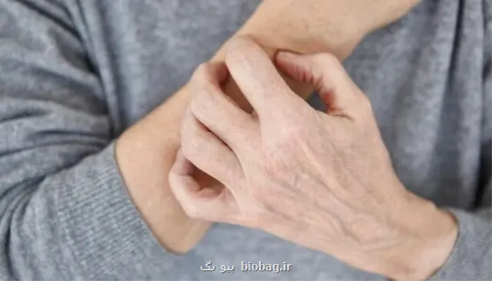 نشانه های پوستی که از بیماری خبر می دهند